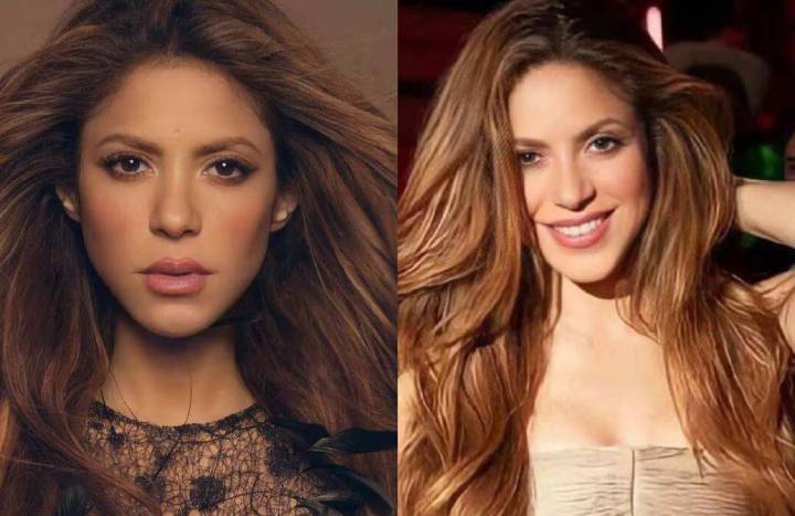 Petición de Admiradores a Shakira: Renunciar a Intervenciones en los Labios y Cirugías Estéticas